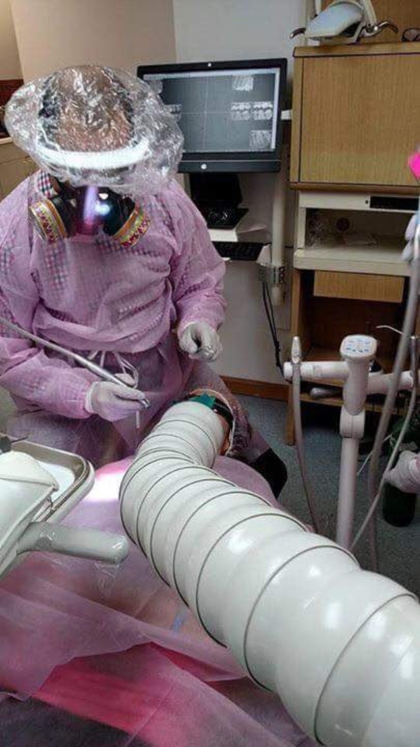 Dental team wearing protective equipment during amalgam removal